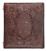 [EARLY PHOTOGRAPHY]. A pair of sixth plate daguerreotypes featuring subjects with physical deformities, comprising: