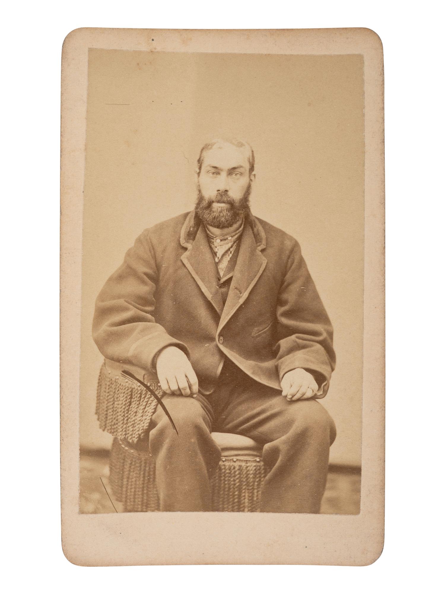 CDV of Union Pacific Railroad employee William Thompson after being scalped by Cheyenne Indians. Omaha, NE: Eaton, ca 1867.