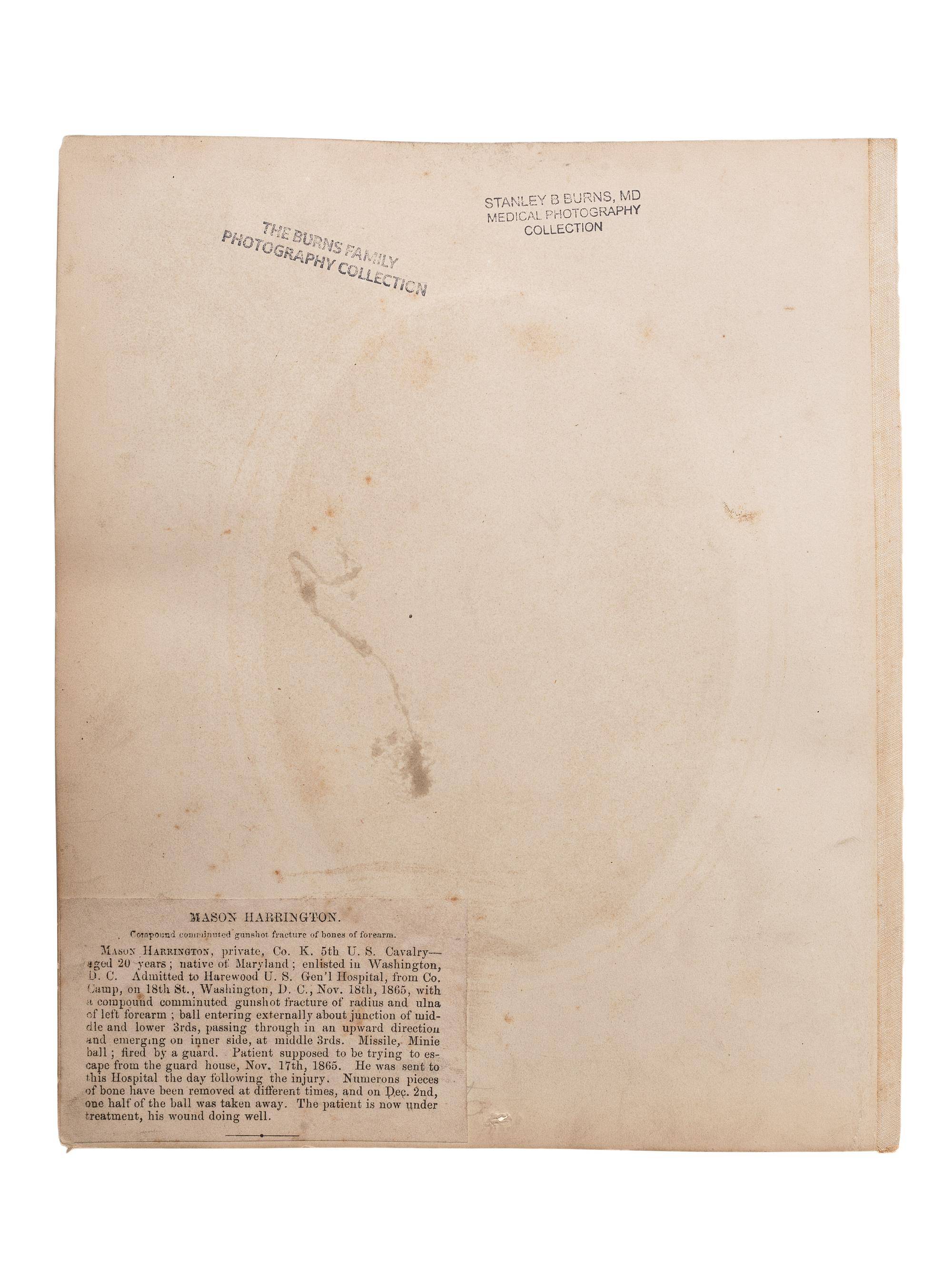 [CIVIL WAR]. Albumen photograph of Private Mason Harrington, Company K, 5th Regiment, US Cavalry, wounded escaping from a guardhouse, 18 November 1865, photographed and assembled by Reed Brockway Bontecou, M.D.