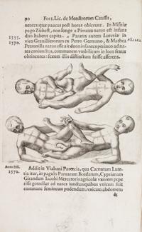 LICETUS, FORTUNIS. De monstrorum natura... Padua, 1634. First illustrated ed. of a work on "monsters" or physical deformities.