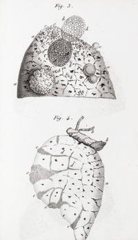LAENNEC, R.T. Traite de L'Auscultation mediate... Paris, 1826. 2 vols. Second edition.