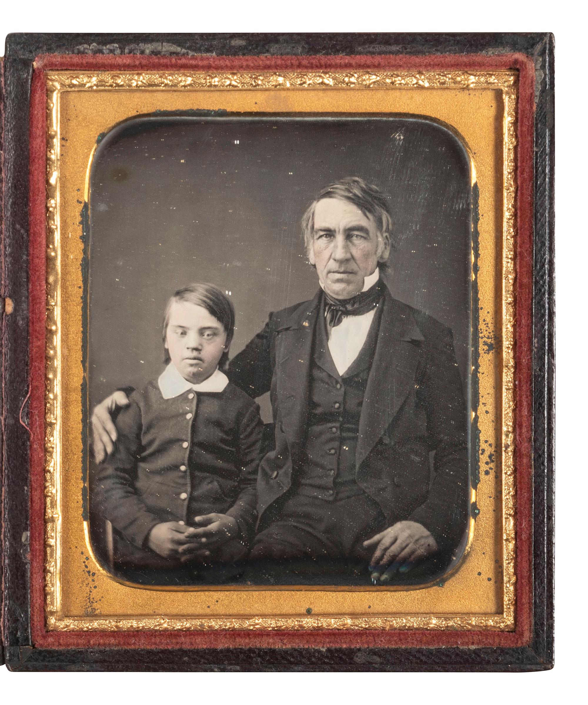 [EARLY PHOTOGRAPHY]. Sixth plate daguerreotype featuring a young boy with Down syndrome.