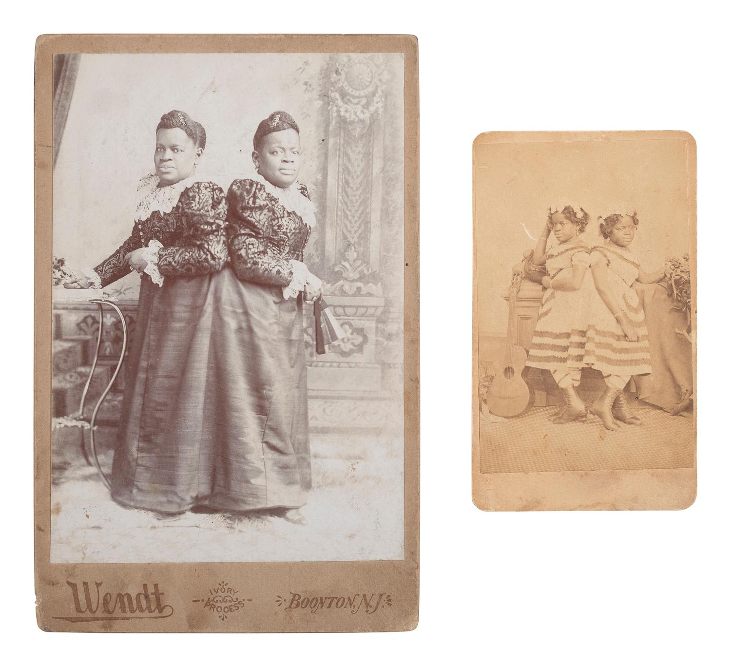 [MUSIC - EARLY PHOTOGRAPHY]. Two photographs of African American conjoined twins Millie-Christine.