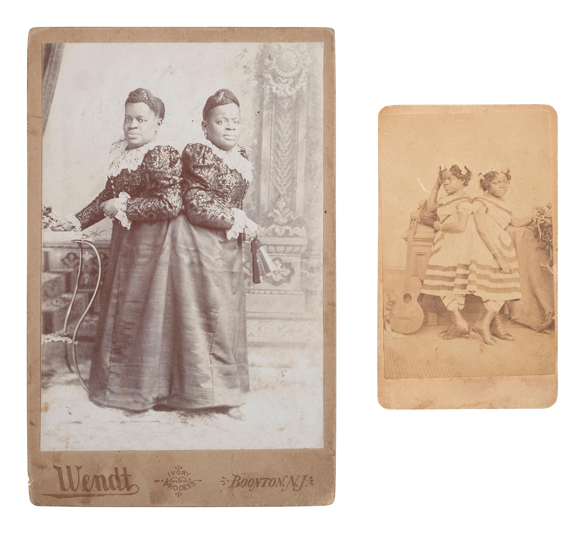 [MUSIC - EARLY PHOTOGRAPHY]. Two photographs of African American conjoined twins Millie-Christine.