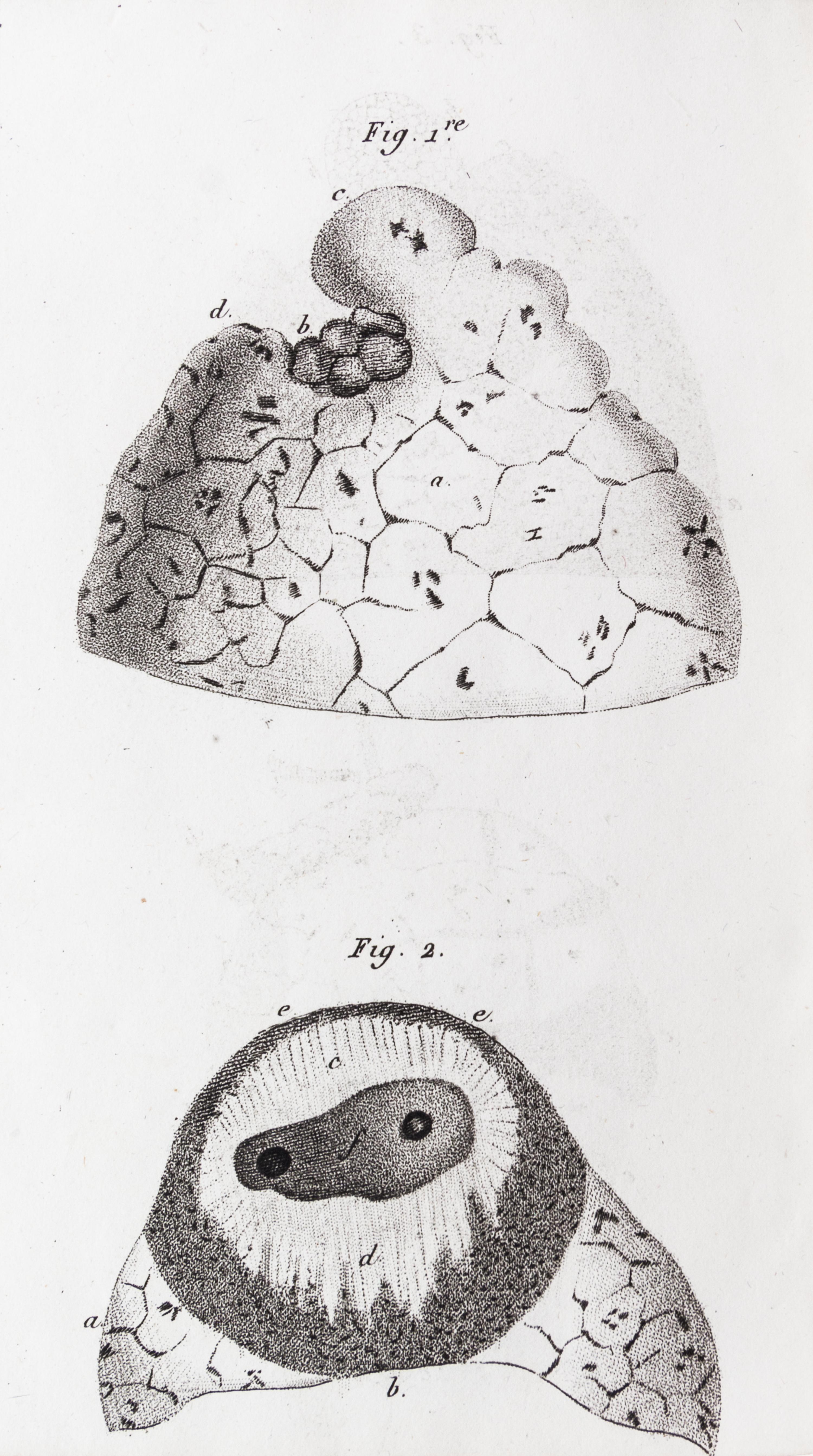 LAENNEC, R.T. Traite de L'Auscultation mediate... Paris, 1826. 2 vols. Second edition.