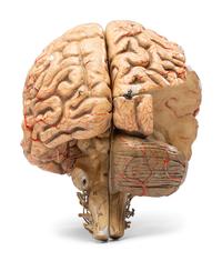A Painted Plaster Brain Section Model
