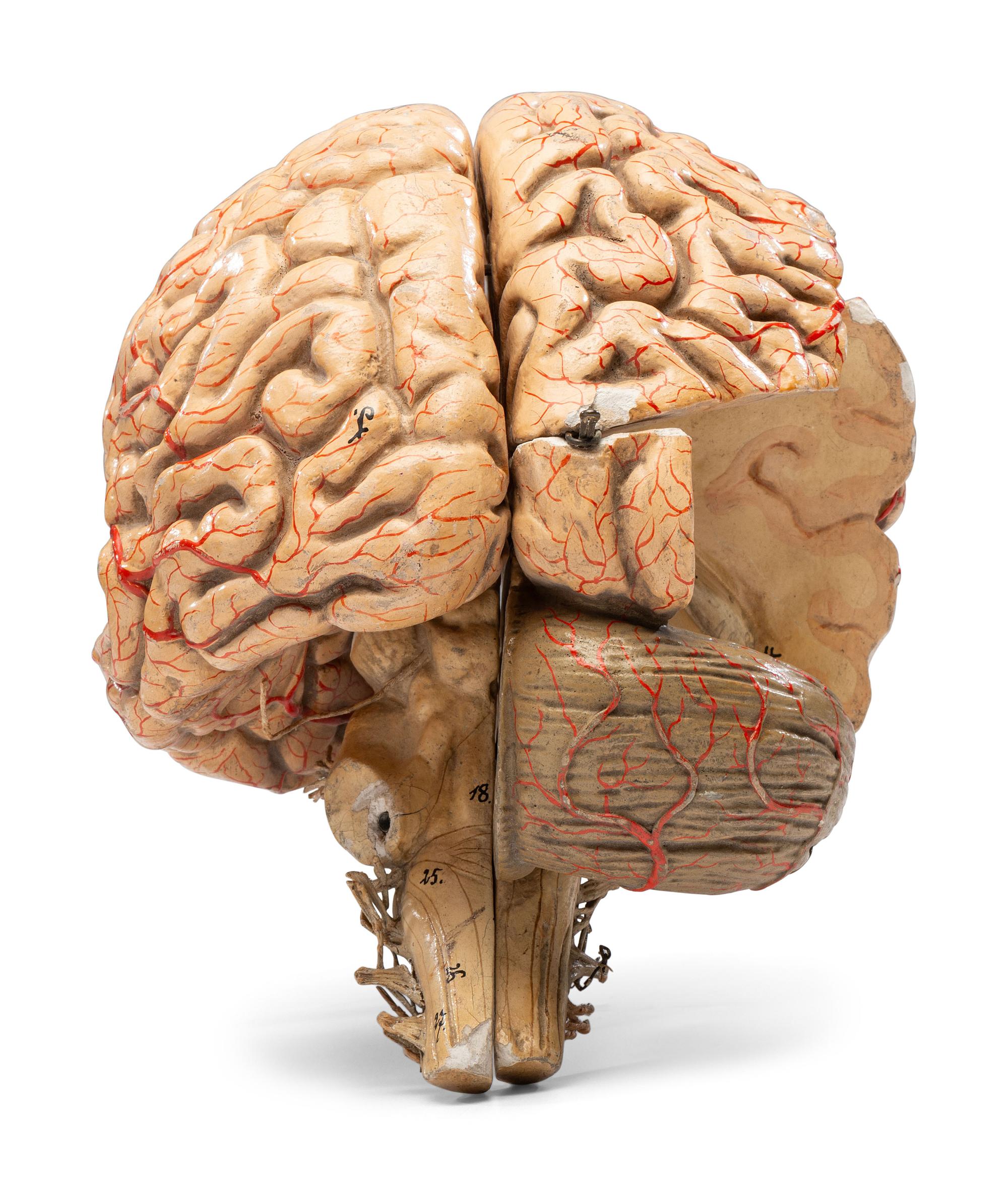 A Painted Plaster Brain Section Model