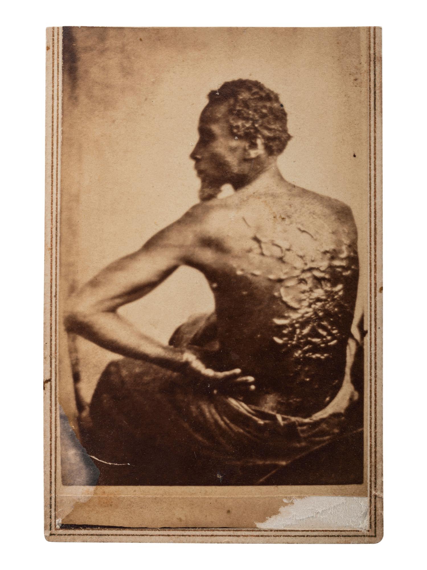 [SLAVERY & ABOLITION]. CDV of an enslaved African American "Gordon" displaying his scars. [Baton Rouge]: [McPherson & Oliver], ca 1863.