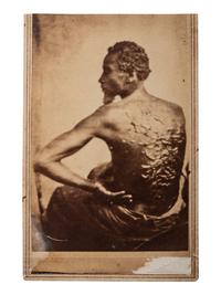[SLAVERY & ABOLITION]. CDV of an enslaved African American "Gordon" displaying his scars. [Baton Rouge]: [McPherson & Oliver], ca 1863.