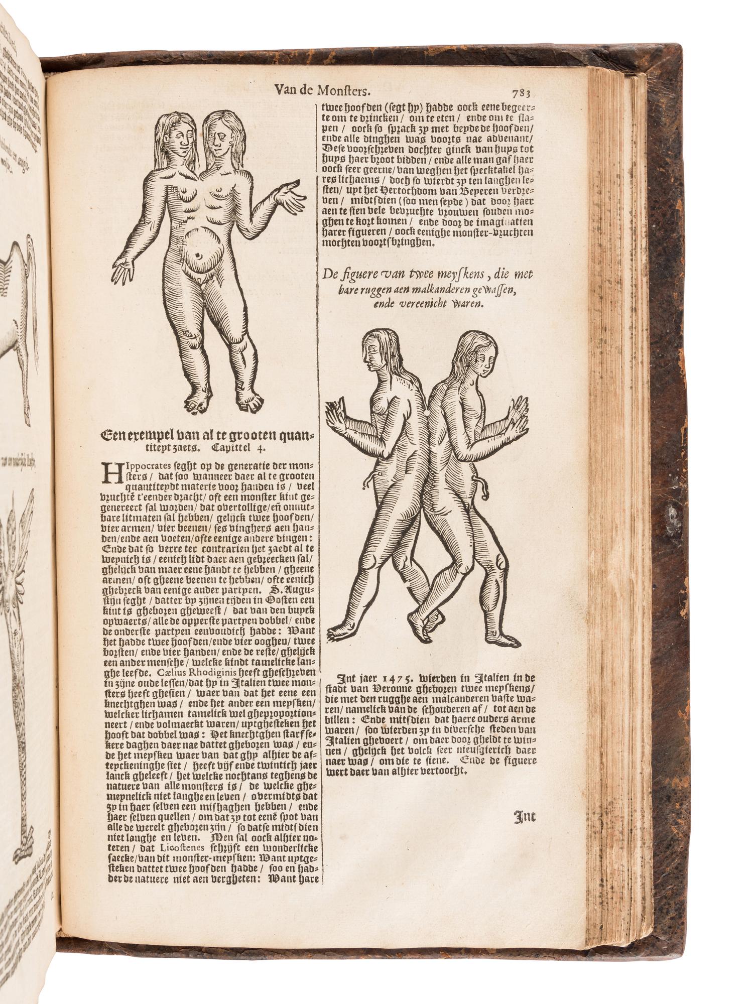 PARE, Ambroise (1510?-1590). De Chirurgie ende alle de Opera . Haarlem: Harman Kranepol for Hendrick Laurensz, 1627.