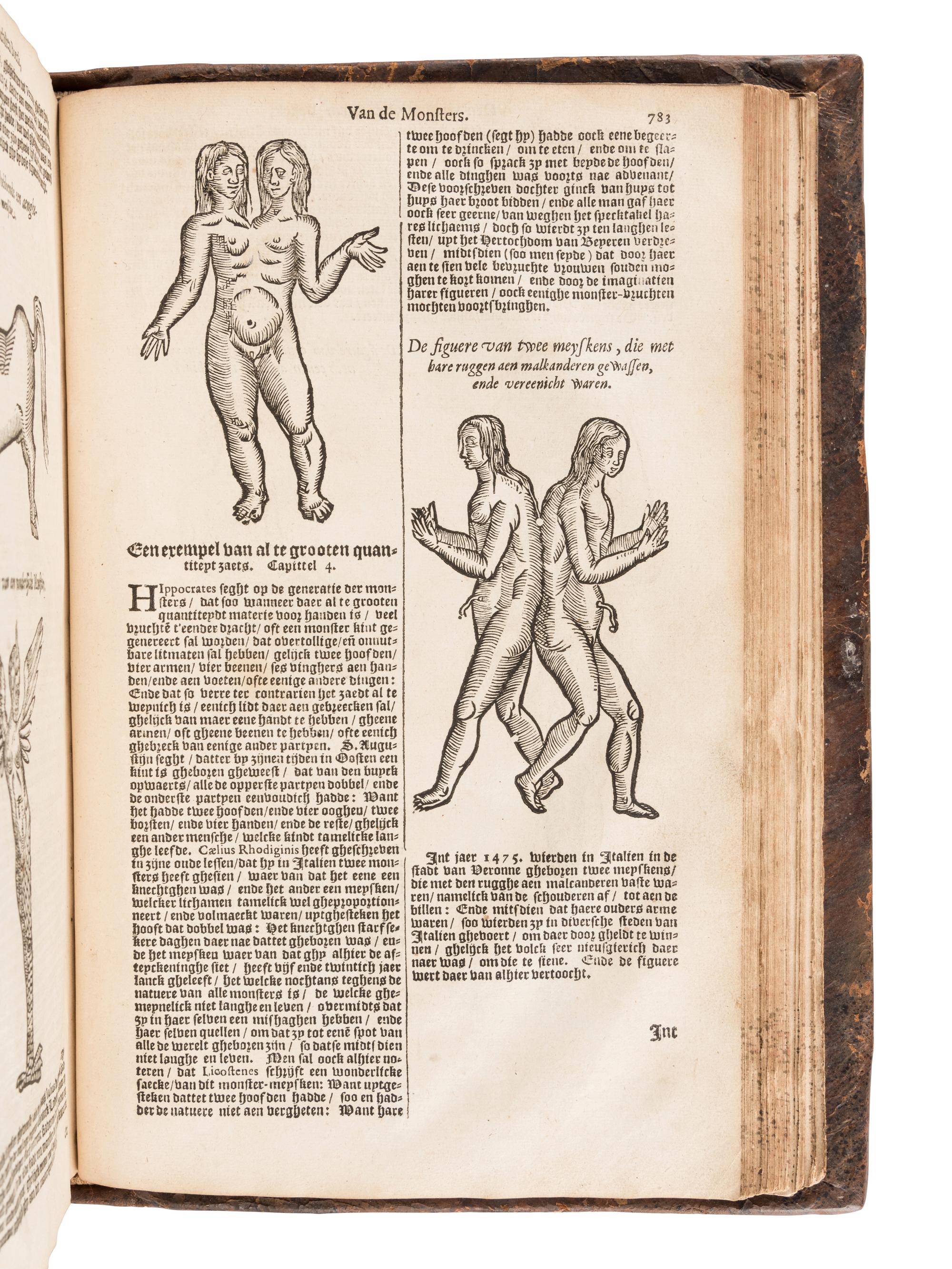 PARE, Ambroise (1510?-1590). De Chirurgie ende alle de Opera . Haarlem: Harman Kranepol for Hendrick Laurensz, 1627.