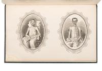 SURBY, Richard W. (b. 1832). Grierson Raids, and Hatch's Sixty-Four Days March, with Biographical Sketches, also the Life and Adventures of Chickasaw, the Scout . Chicago: Rounds and James, Steam Book and Job Printers, 1865.