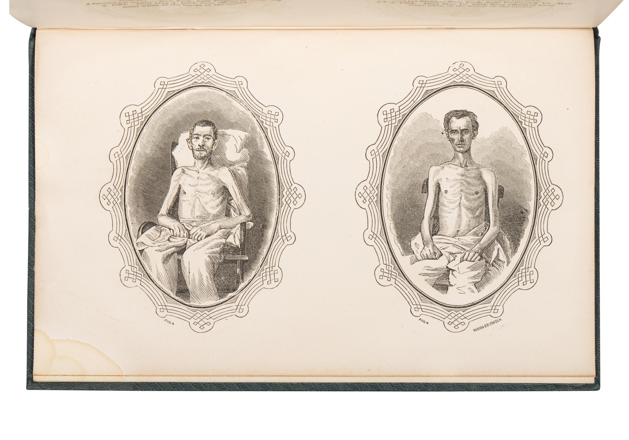 SURBY, Richard W. (b. 1832). Grierson Raids, and Hatch's Sixty-Four Days March, with Biographical Sketches, also the Life and Adventures of Chickasaw, the Scout . Chicago: Rounds and James, Steam Book and Job Printers, 1865.