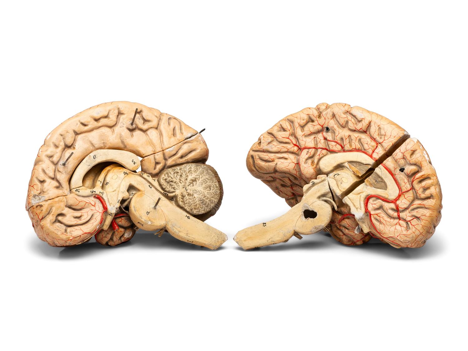 A Painted Plaster Brain Section Model