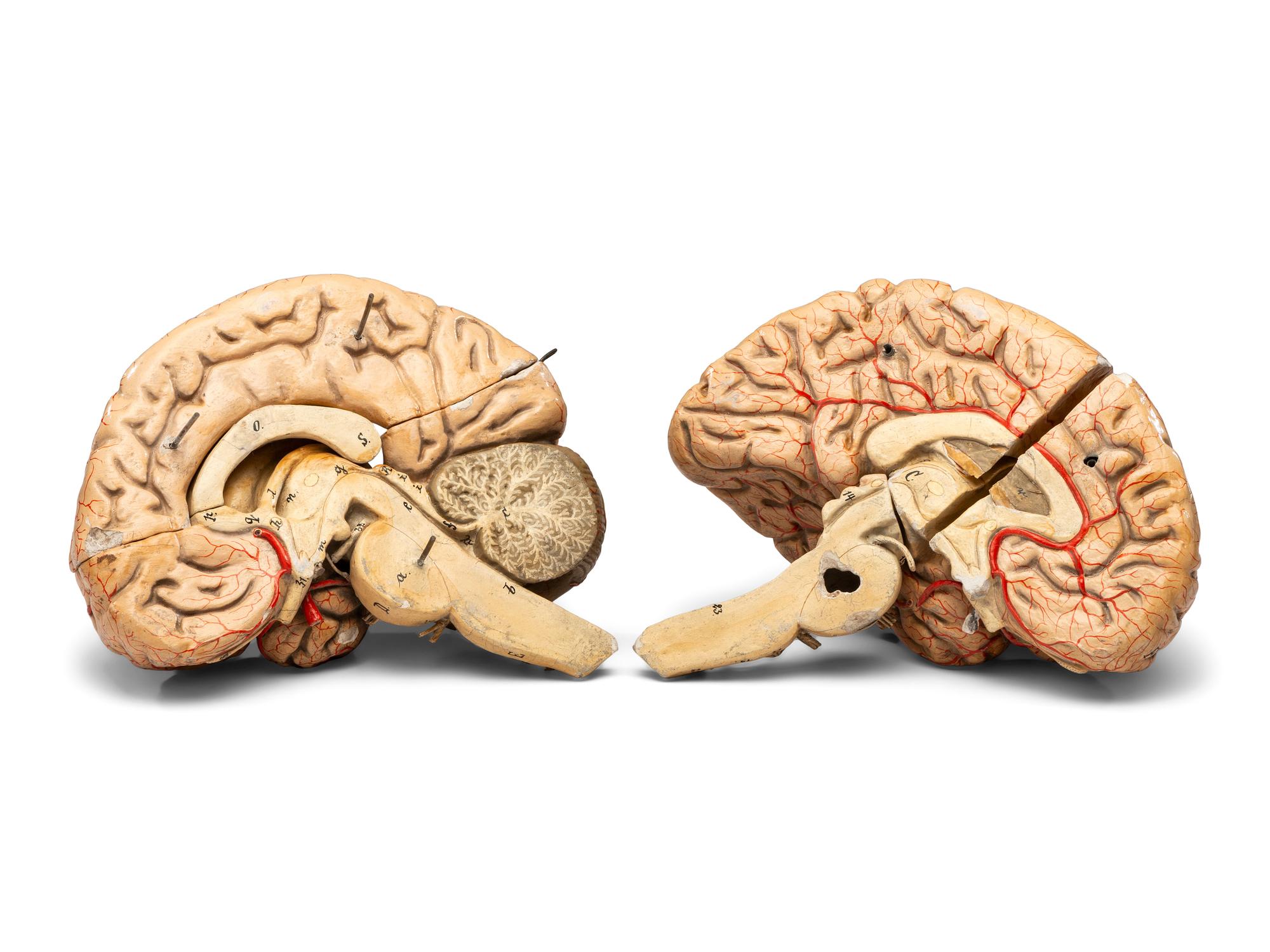 A Painted Plaster Brain Section Model