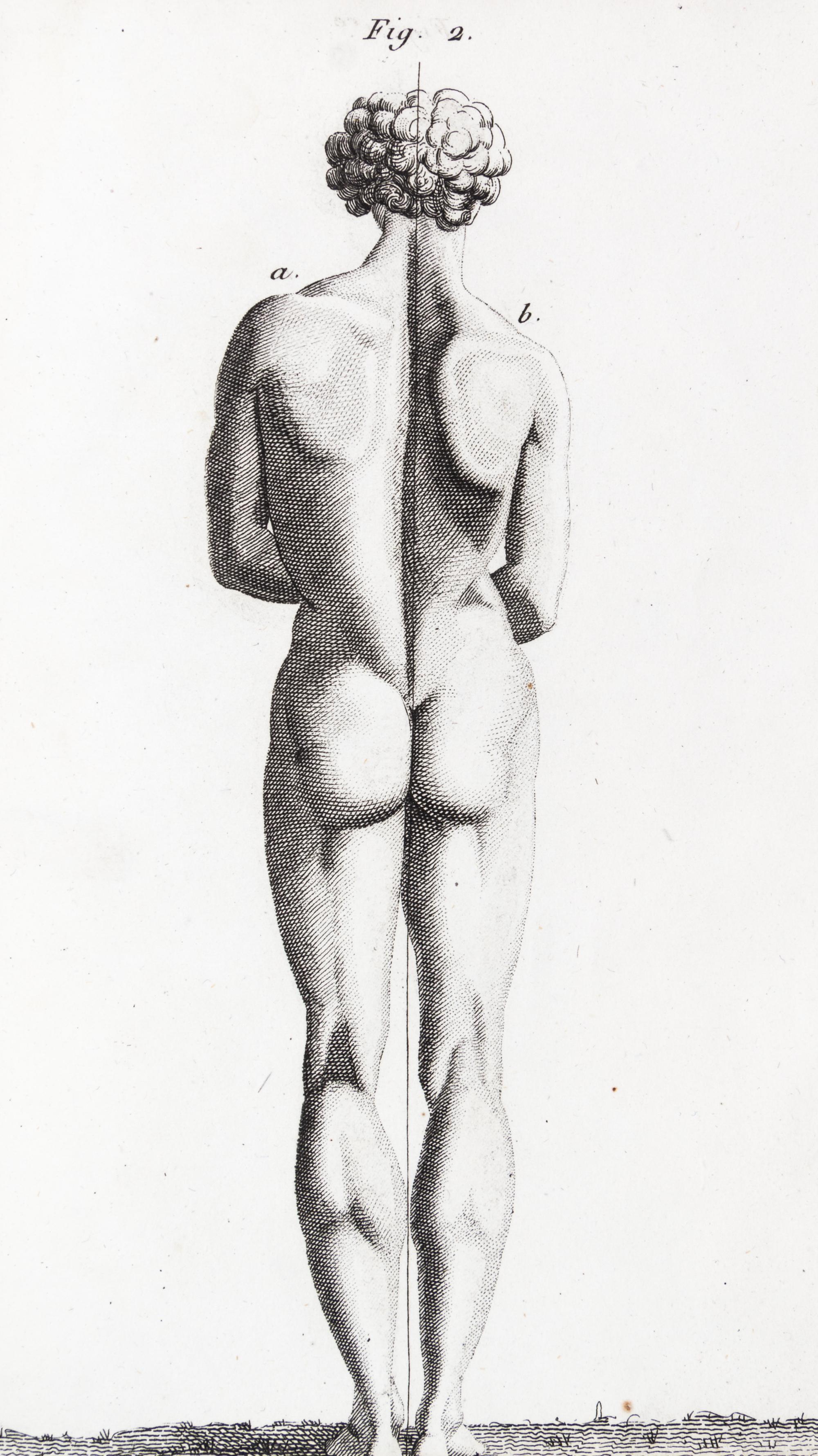LAENNEC, R.T. Traite de L'Auscultation mediate... Paris, 1826. 2 vols. Second edition.