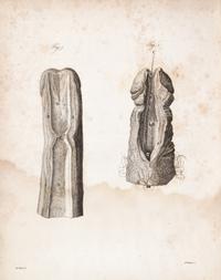 HUNTER, JOHN. A Treatise on the Venereal Disease. London, 1786. First edition.