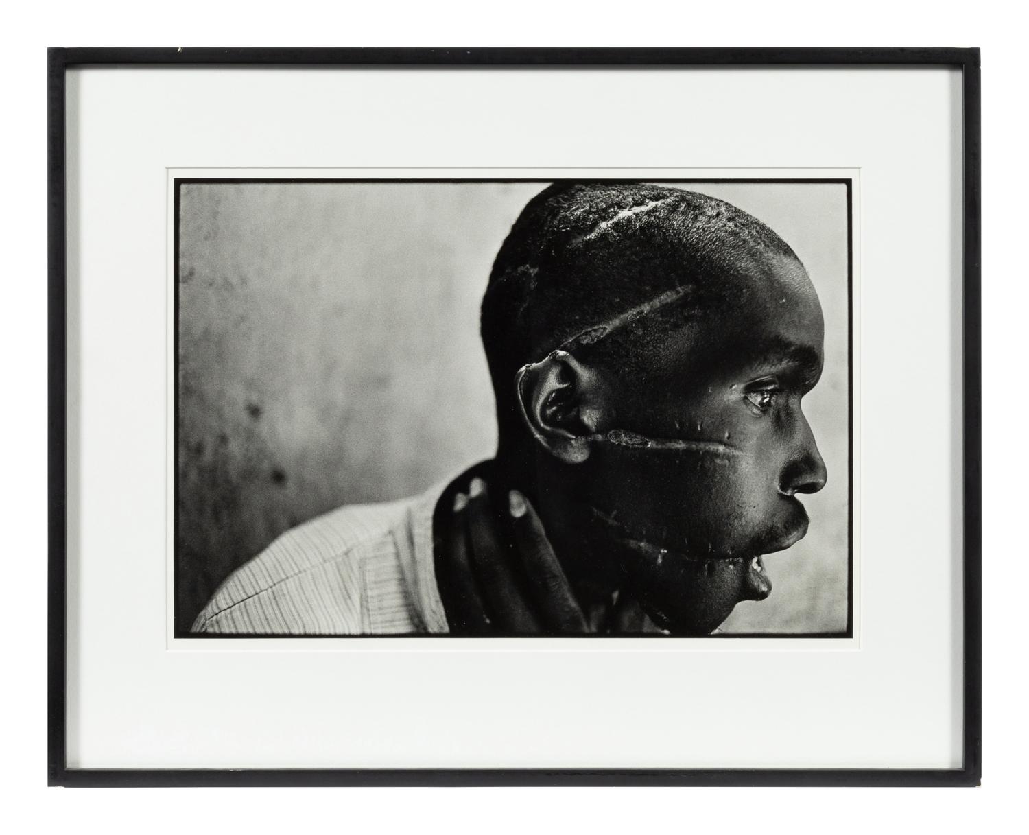 Survivor of Hutu death camp, Rwanda , June 1994