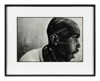 Survivor of Hutu death camp, Rwanda , June 1994