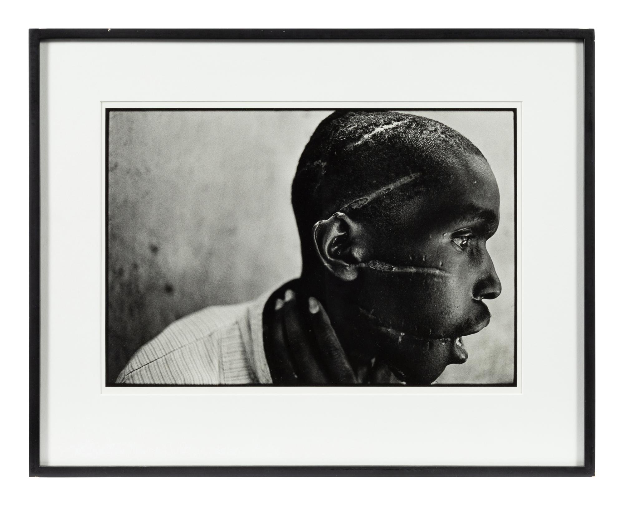Survivor of Hutu death camp, Rwanda , June 1994