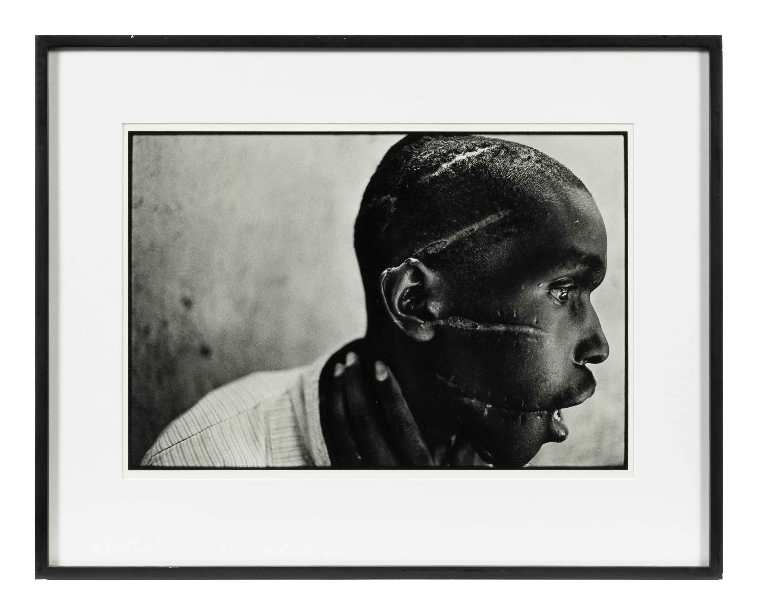 Survivor of Hutu death camp, Rwanda , June 1994