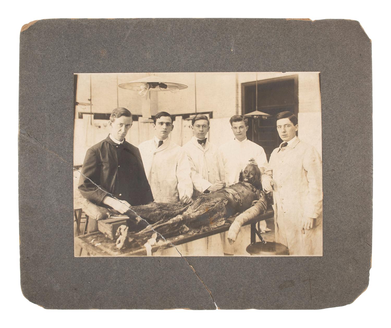 [MCKINLEY, William]. 2 photos of the dissection of the body of Czolgosz's apprehender. Ca 1908.