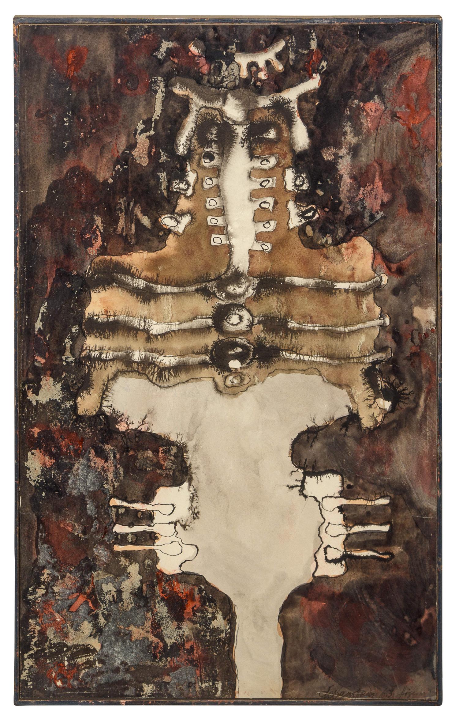 Figure #4
