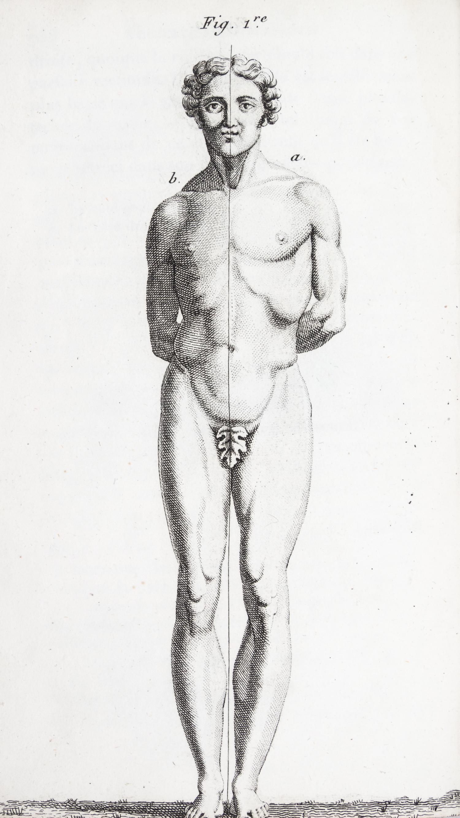 LAENNEC, R.T. Traite de L'Auscultation mediate... Paris, 1826. 2 vols. Second edition.