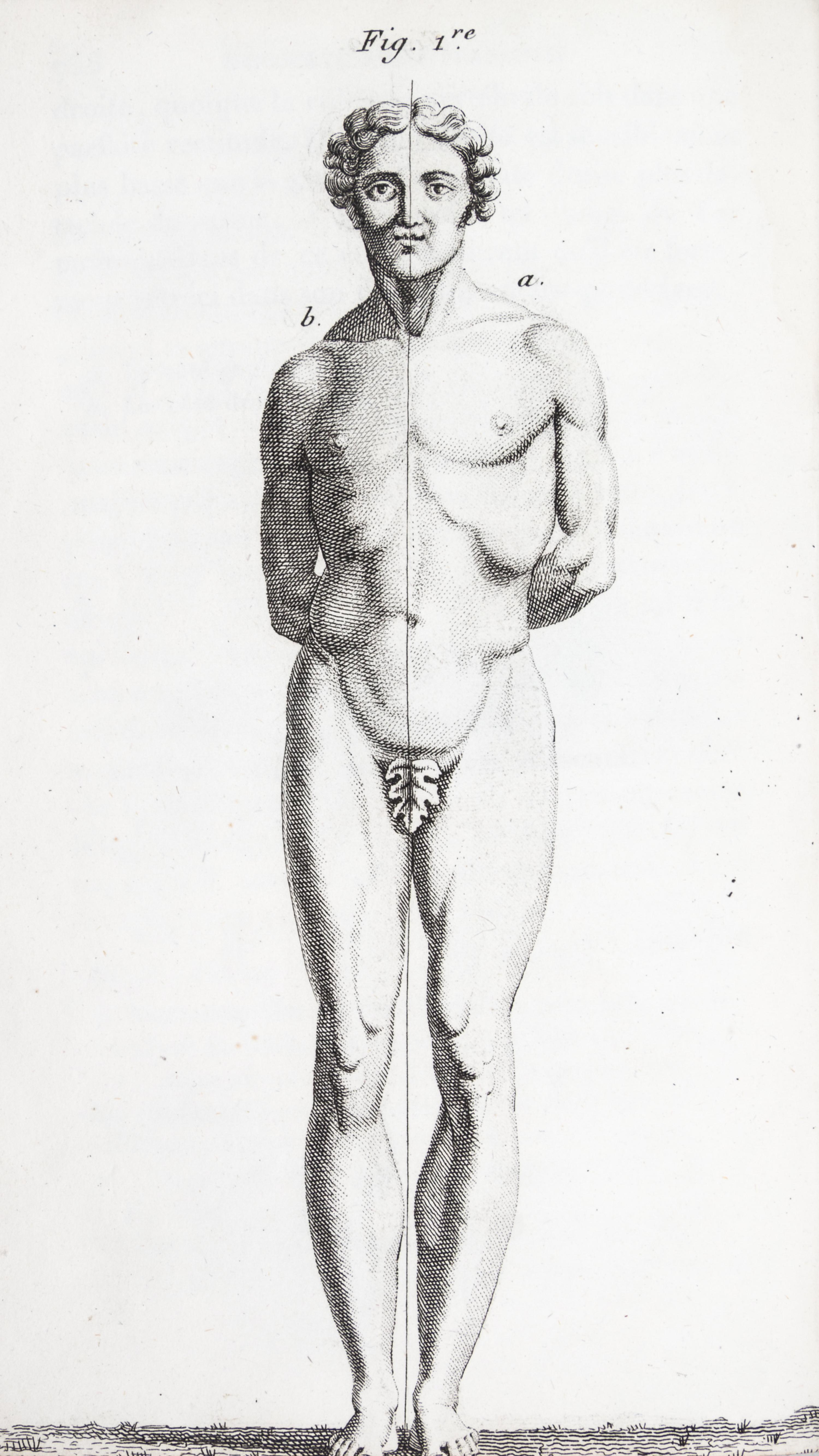 LAENNEC, R.T. Traite de L'Auscultation mediate... Paris, 1826. 2 vols. Second edition.