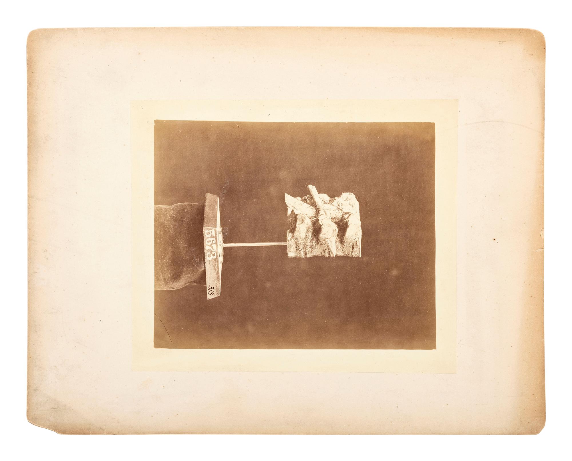 Indian Wars -- Texas Arrow impacted in the Tranverse [sic] Process of the Fourth Dorsal Vertebra . Army Medical Museum, ca 1869.