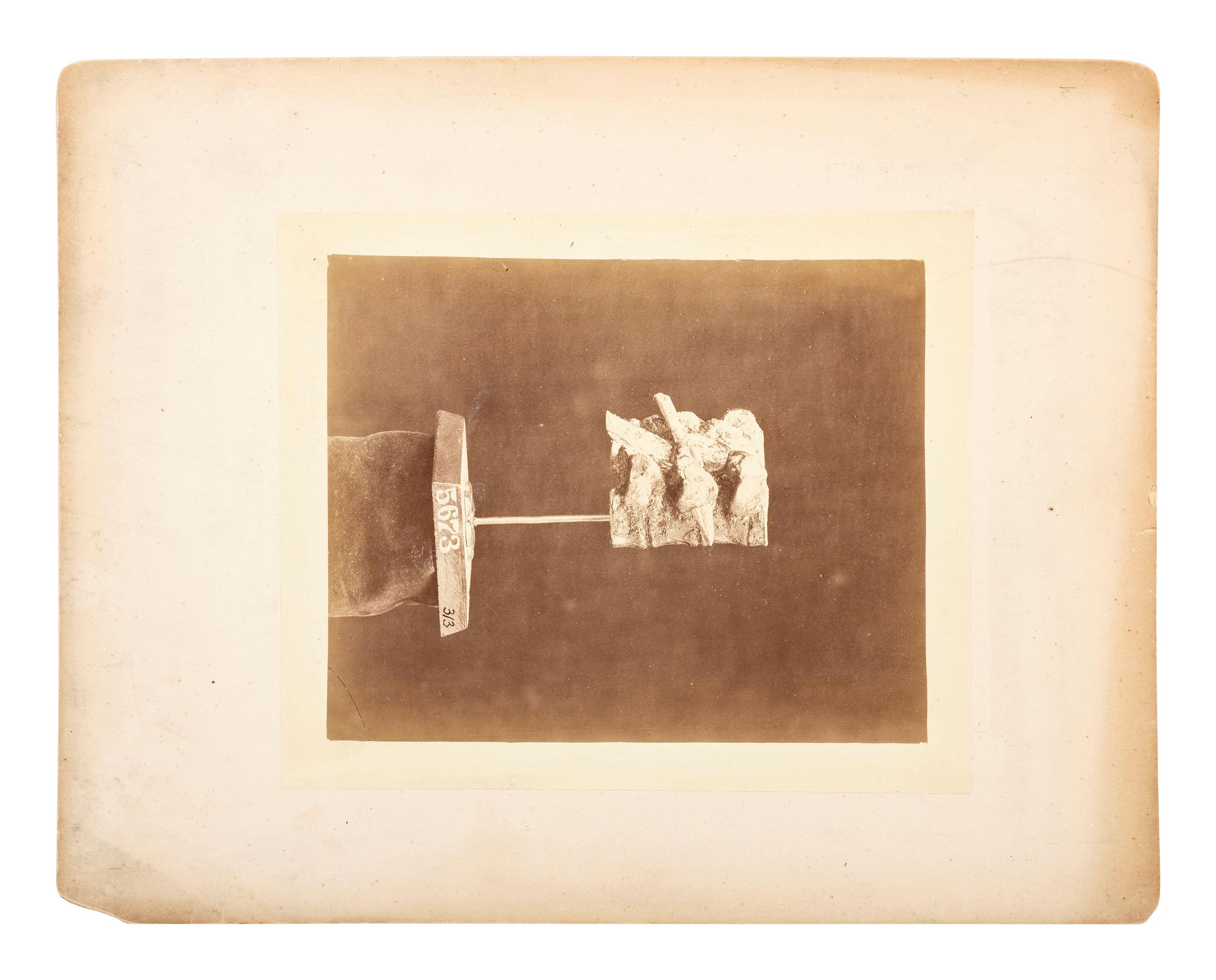 Indian Wars -- Texas Arrow impacted in the Tranverse [sic] Process of the Fourth Dorsal Vertebra . Army Medical Museum, ca 1869.