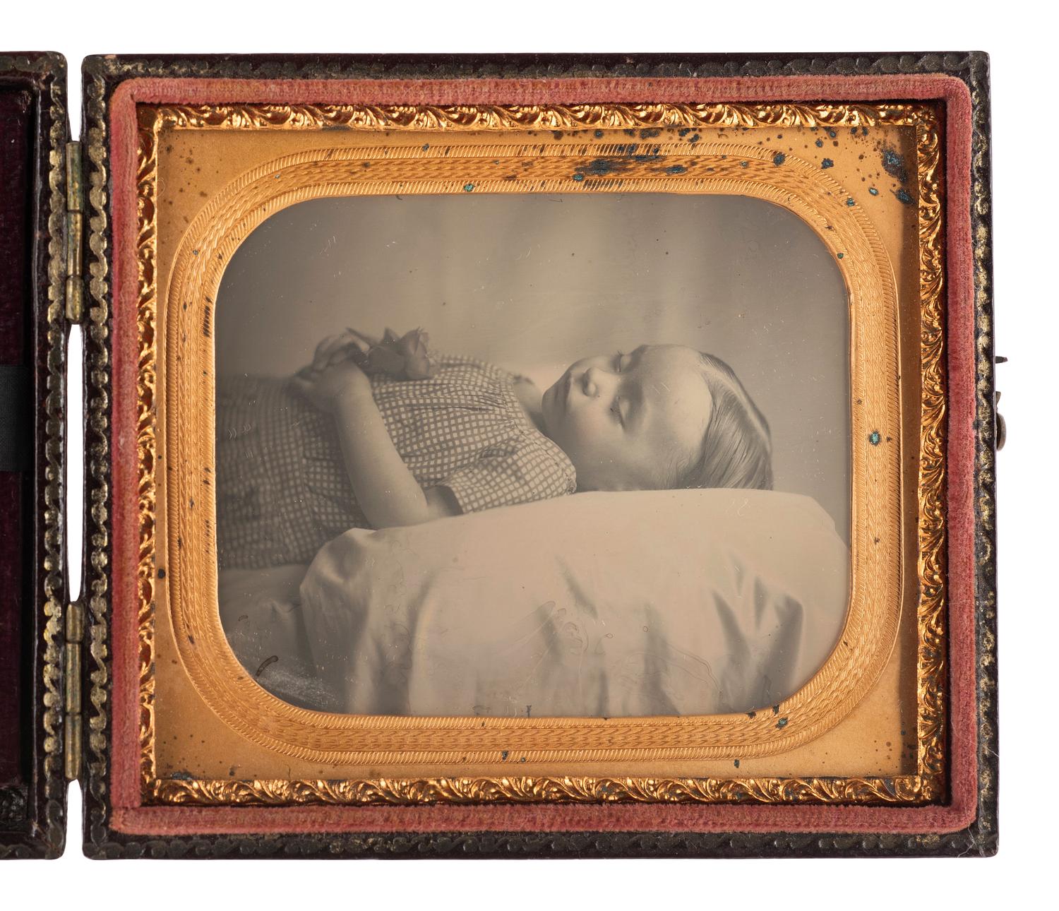 [EARLY PHOTOGRAPHY]. Sixth plate postmortem daguerreotype of a young child housed in a Mascher Magnifying Case.