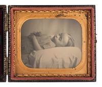 [EARLY PHOTOGRAPHY]. Sixth plate postmortem daguerreotype of a young child housed in a Mascher Magnifying Case.